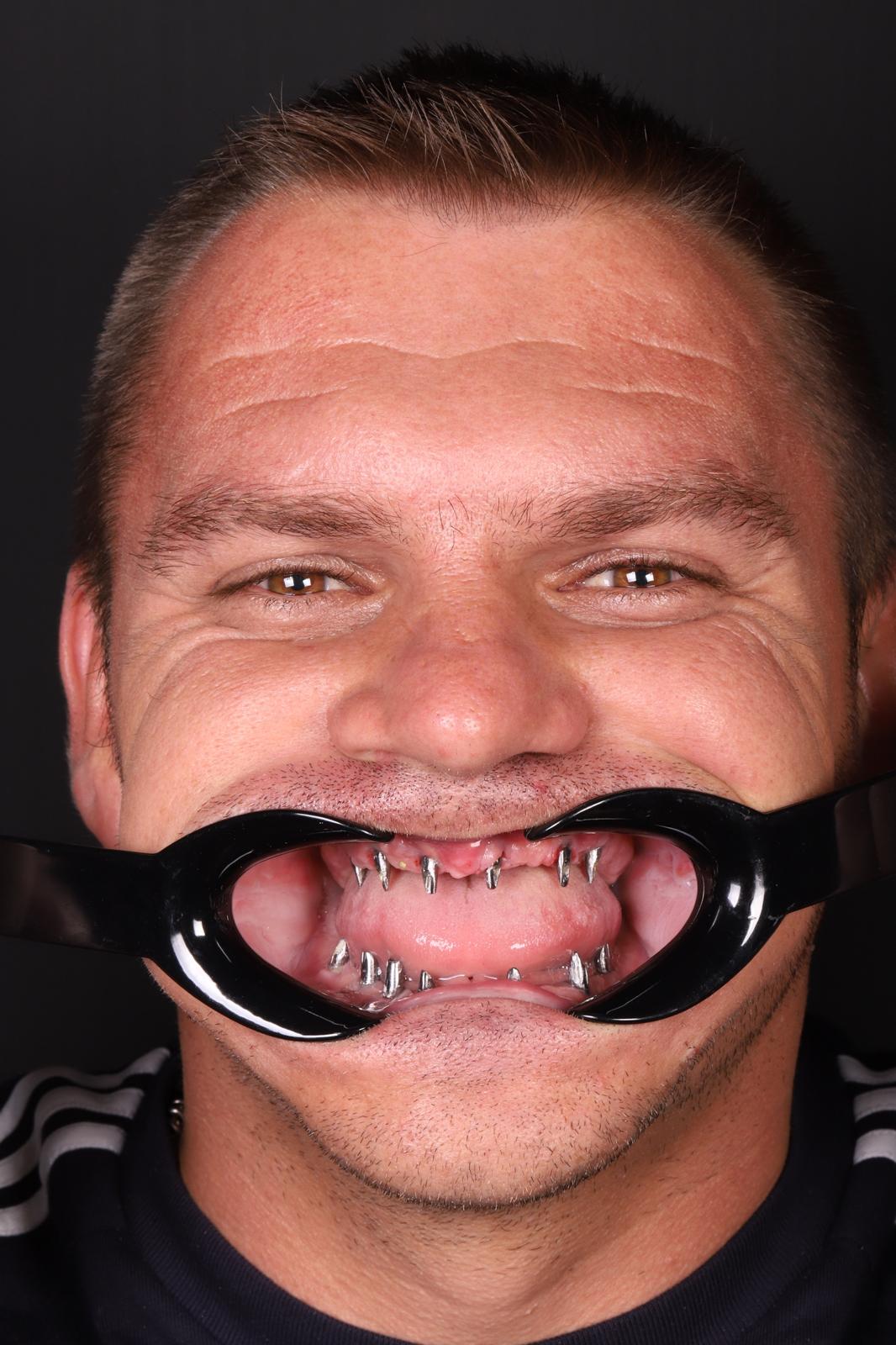 clínica dental en turquía