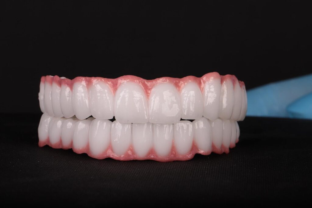 impresión-digital-implantes-all-on-four