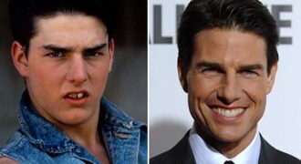 famosos-con-carillas-antes-y-después-tom-cruise